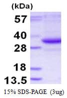 Human TATDN3 Protein (Recombinant His)