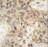 Polyclonal Rabbit anti-Human ANGEL2 Antibody (aa108-138, IHC, WB)