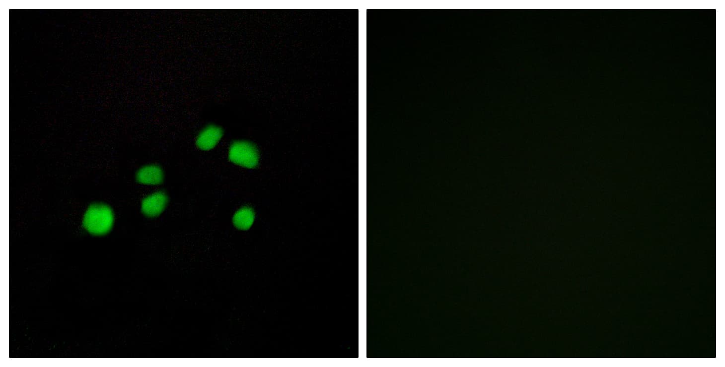 COL23A1 / Collagen XXIII Antibody (aa461-510)