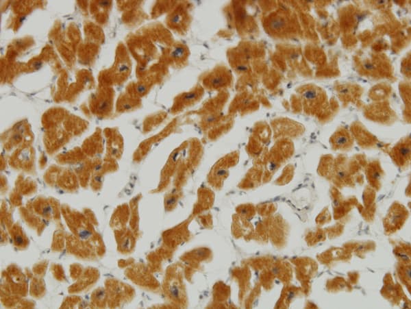 Mitofusin 2 / MFN2 Antibody (clone 4H8)
