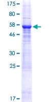 Human SUSD4 Protein (Recombinant GST)