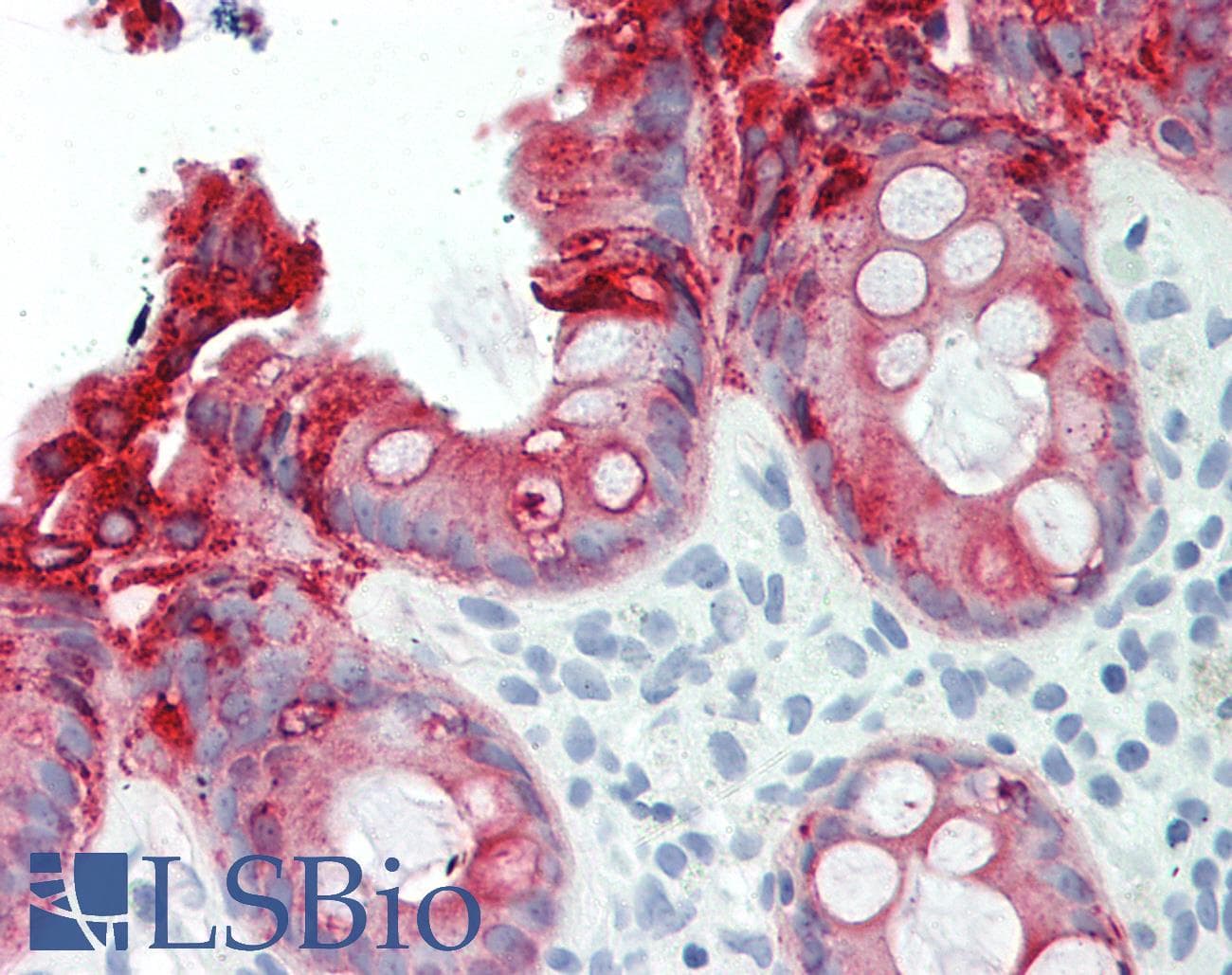 PathPlus™ AGR2 Antibody (aa21-175)