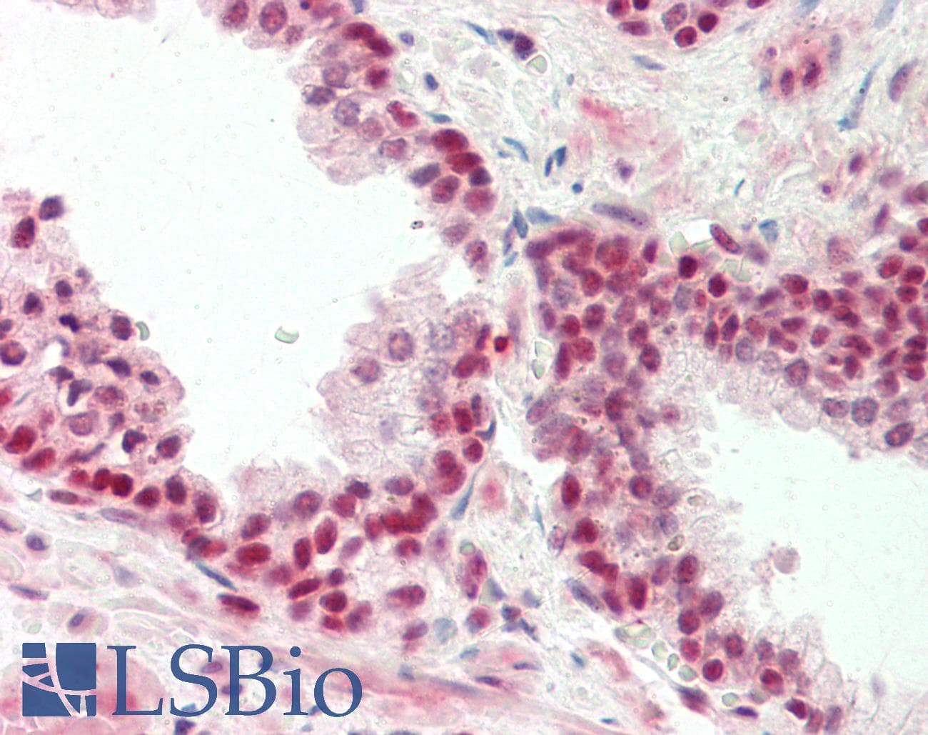 IHC-plus™ ZNF461 Antibody (aa126-425)