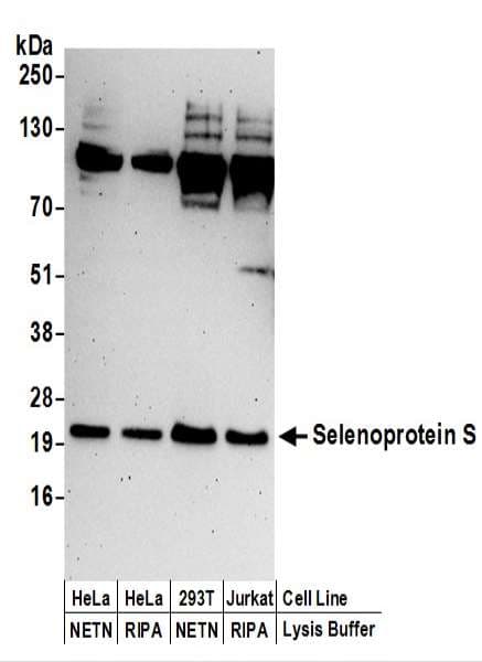 SELS Antibody (aa125-175)