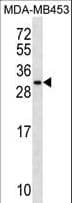 MRPS10 Antibody (aa113-141)
