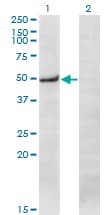 Monoclonal Mouse anti-Human PRKX Antibody (clone 1H7, WB)
