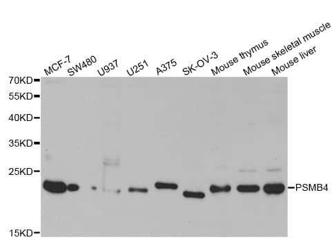 Polyclonal Rabbit anti-Human PSMB4 Antibody (IHC, IF, WB)