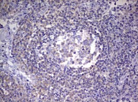 Monoclonal Mouse anti-Human PR / Progesterone Receptor Antibody (clone OTI11E8, aa1-298, IHC, WB)