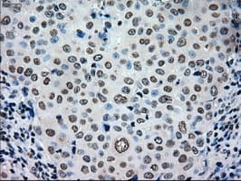 TYRO3 Antibody (clone OTI5B4)