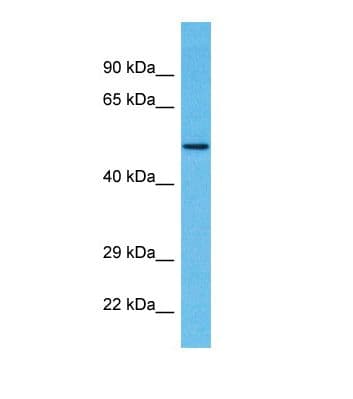Polyclonal Rabbit anti-Human ZSCAN22 Antibody (aa51-100, WB)