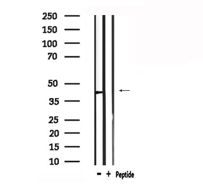 Polyclonal Rabbit anti-Human AGTR1 / AT1 Receptor Antibody (IHC, IF, WB)