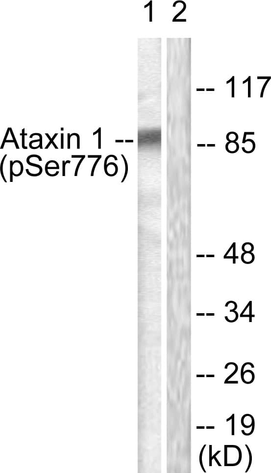 ATXN1 / SCA1 Antibody (phospho-Ser776)