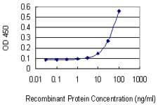 Monoclonal Mouse anti-Human ZEB1 / AREB6 Antibody (clone 4C4, IF, WB)