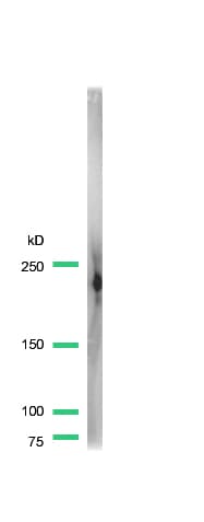 IHC-plus™ Dysferlin Antibody (C-Terminus)