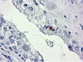 HDHD2 Antibody (clone OTI3H8, Carrier-free)