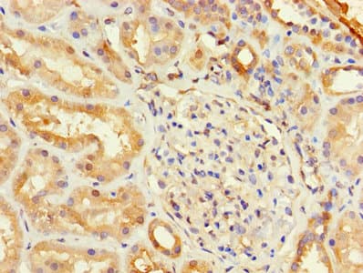 Polyclonal Rabbit anti-Human TSTA3 / GDP-L-Fucose Synthase Antibody (IHC, WB)