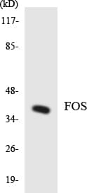 Polyclonal Rabbit anti-Human FOS / c-FOS Antibody (aa177-226, WB)