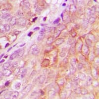 NMT2 Antibody