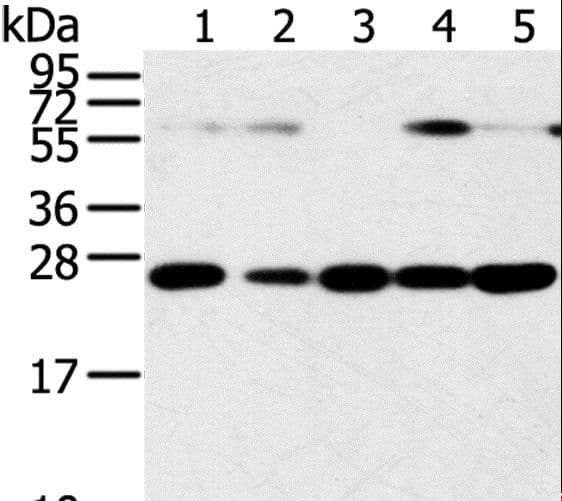 SNAP23 / SNAP-23 Antibody