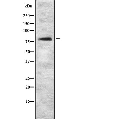 RPS6KA2 / RSK3 Antibody