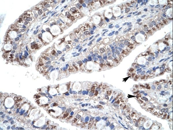 Polyclonal Rabbit anti-Human CCL18 / PARC Antibody (HRP, C-Terminus, IHC, WB)
