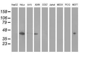 MVK Antibody (clone OTI 1D7, Carrier-free)