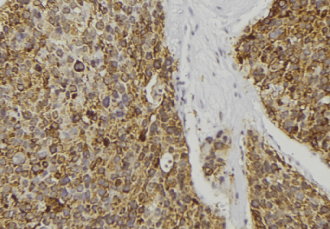 REG3A Antibody