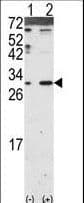 IHC-plus™ DKK2 Antibody (aa31-62)