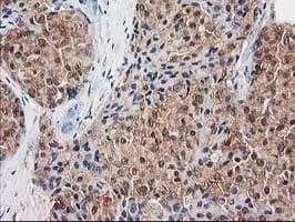 DSTN / Destrin Antibody (clone OTI1C5, Carrier-free)