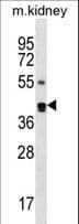 Polyclonal Rabbit anti-Human CYTH2 / Cytohesin 2 Antibody (aa36-64, WB)