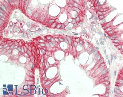IHC-plus™ LGALS9 / Galectin 9 Antibody (clone 19H8)