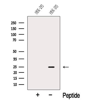 Polyclonal Rabbit anti-Human ILEI / FAM3C Antibody (WB)