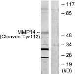 Polyclonal Rabbit anti-Human MMP14 Antibody (aa93-142, WB)