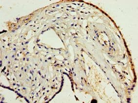 Polyclonal Rabbit anti-Human ADAM33 Antibody (aa140-420, IHC)