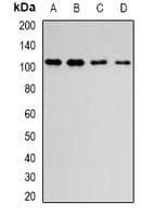 Polyclonal Rabbit anti-Human Dipeptidylpeptidase 8 / DPP8 Antibody (IF, WB)