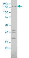 IQGAP1 Antibody (clone 2C5)