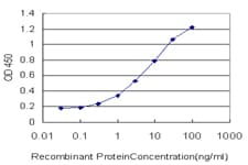 IHC-plus™ Monoclonal Mouse anti-Human MSI1 / Musashi 1 Antibody (clone 3F2, IHC, IF, WB)