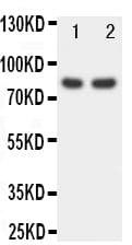 FOXP1 Antibody (aa657-677)
