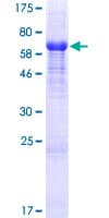 Human RIMKLA Protein (Recombinant GST)