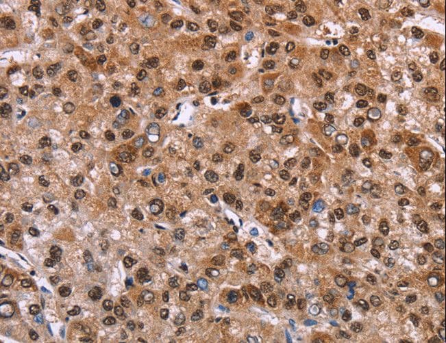 Polyclonal Rabbit anti-Human GPR171 Antibody (IHC)