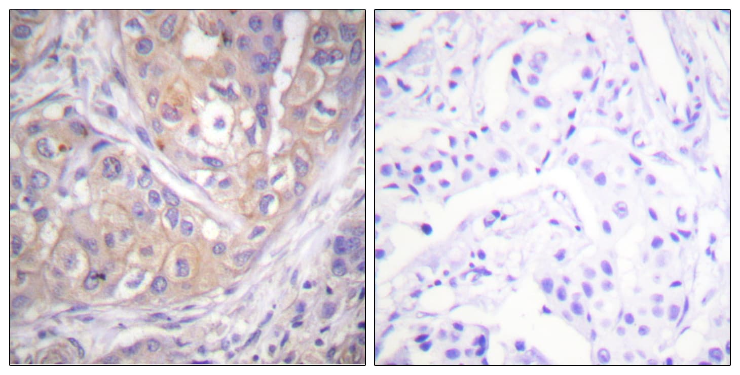 p56lck / LCK Antibody (phospho-Tyr505)