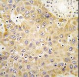 GRK5 Antibody (aa559-590)