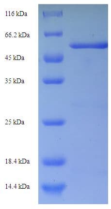 Pseudomonas aeruginosa Beta Lactamase Protein (Recombinant His-SUMO)