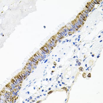 Polyclonal Rabbit anti-Human ACVR2 / ACVR2A Antibody (IHC, WB)