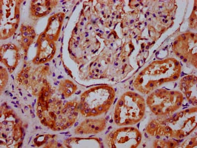 Polyclonal Rabbit anti-Human APMAP / C20orf3 Antibody (IHC, IF, WB)