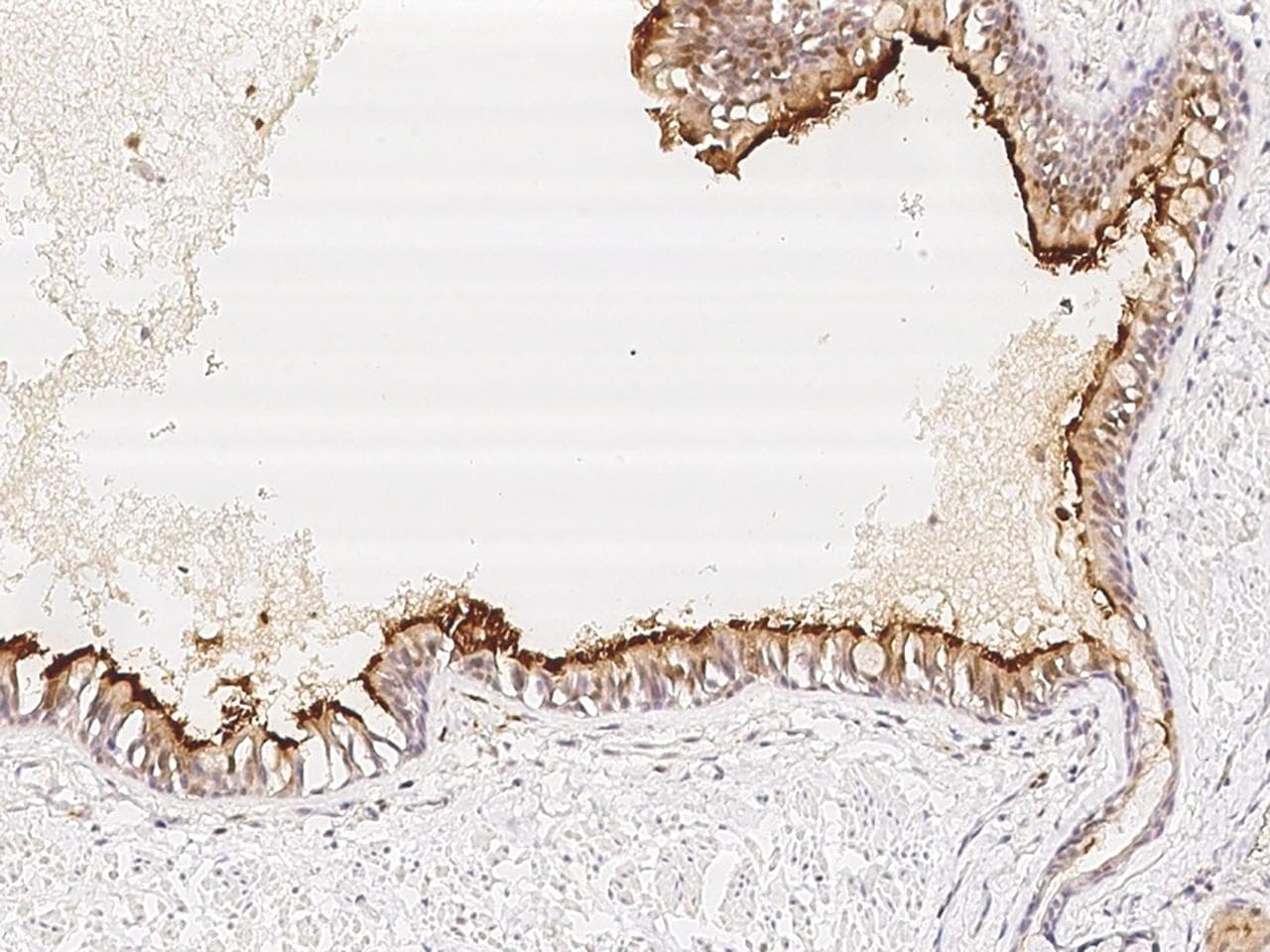 Polyclonal Rabbit anti-Human C5orf49 Antibody (IHC)