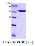 Human SERPINE1 / PAI-1 Protein (Recombinant His)