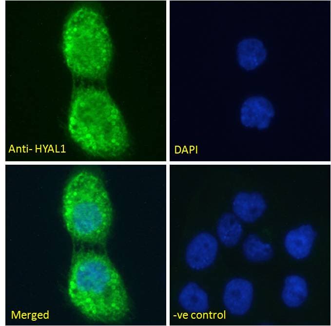 IHC-plus™ Polyclonal Goat anti-Human HYAL1 Antibody (aa325-339, IHC, IF)