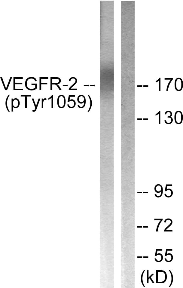 KDR / VEGFR2 / FLK1 Antibody (phospho-Tyr1059)