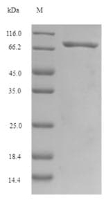 Human MLZE Protein (Recombinant 6His-SUMO, N-terminus)